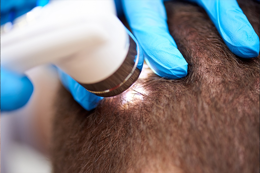 Doctor Hair Clinic Bőrgyógyászati Szakorosi Vizsgálatok