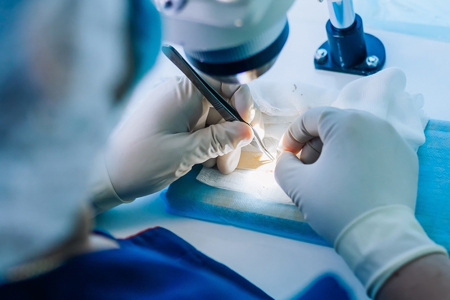 Doctor Hair Clinic FUE Hajbeültetés